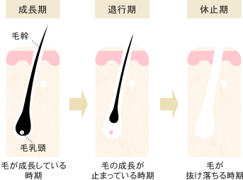 脱毛の治療回数と毛周期